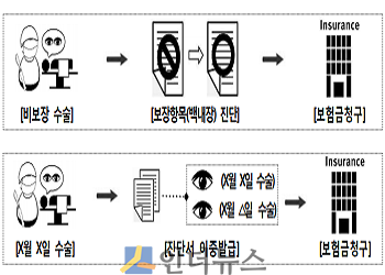 백내장수술 허위청구 사례.(출처: 금감원)