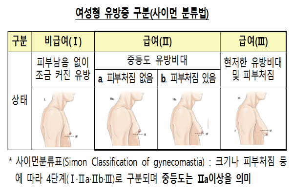 여성형 유방증 구분(출처: 금융감독원)