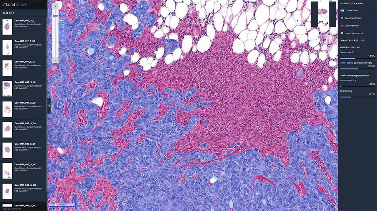 인공지능을 활용한 루닛 조직 슬라이드 영상분석 Lunit SCOPE | 루닛Lunit